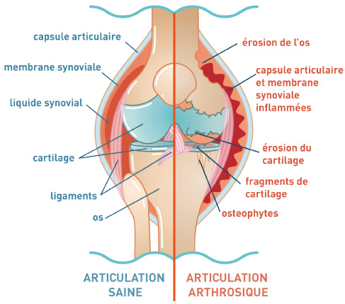 Arthrose chez le Chien : Causes et Traitements Naturels ?